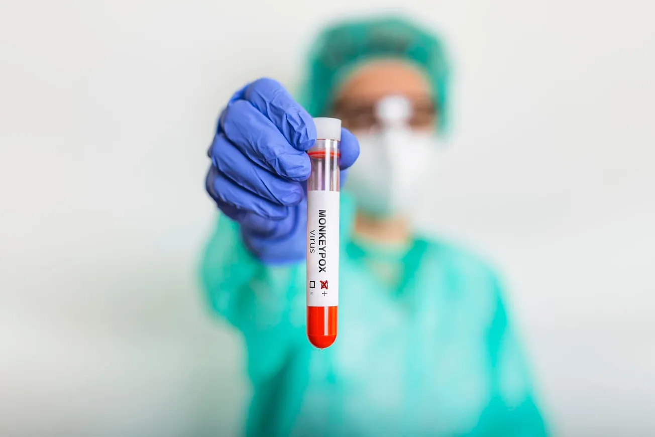 Monkeypox vaccine eligibility expands in Virginia